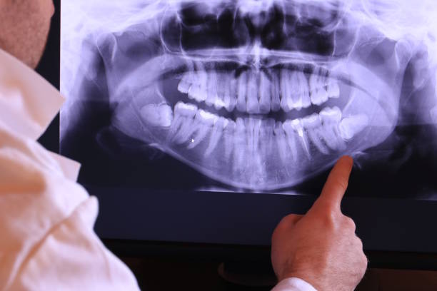 Best Cosmetic Emergency Dentistry in Pine Mountain Clu, CA