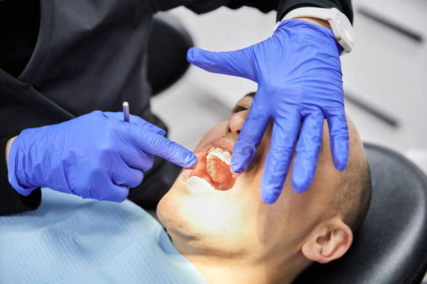 Best Urgent Care for Lost Fillings or Crowns in Pine Mountain Clu, CA